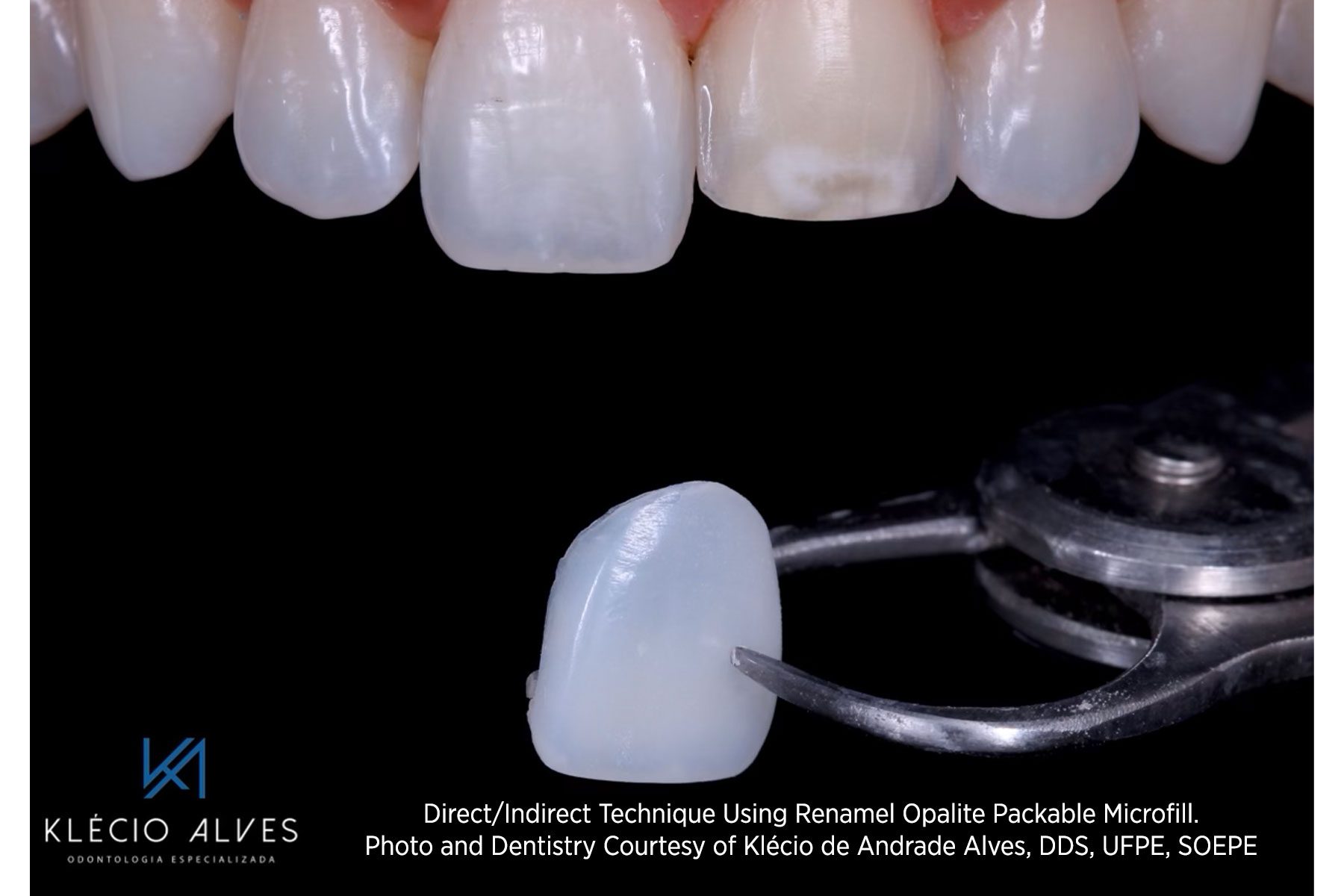 RENAMEL OPAL Y OPALITE - Imagen 5