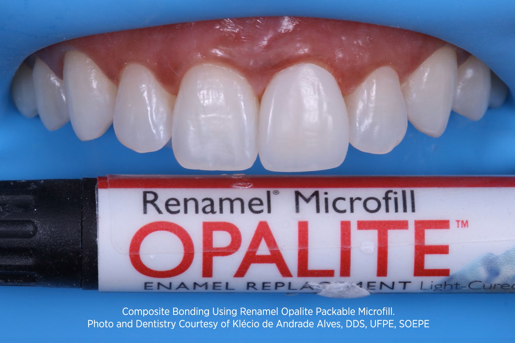 RENAMEL OPAL Y OPALITE - Imagen 4