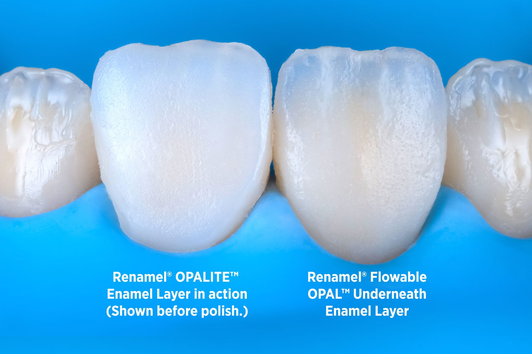RENAMEL OPAL Y OPALITE - Imagen 6
